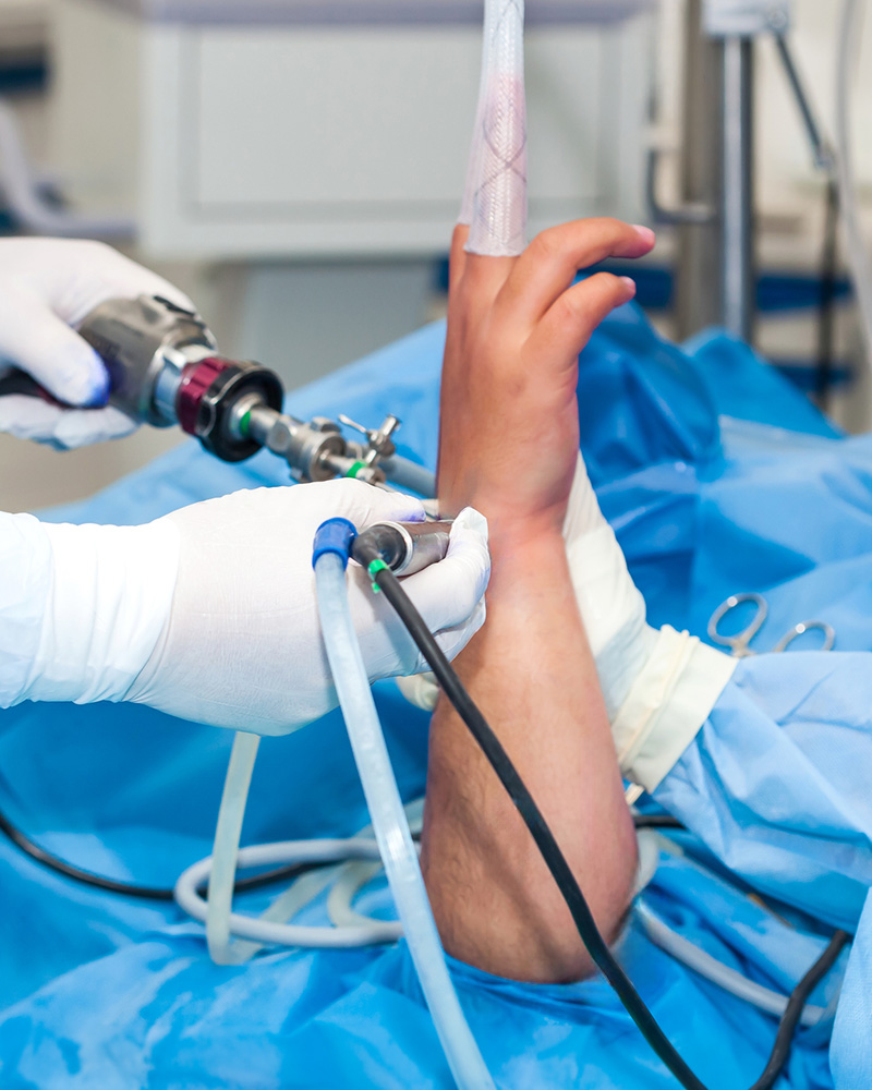 Wrist Arthroscopy I Orthopaedics I St Vincent’s Private Hospitals